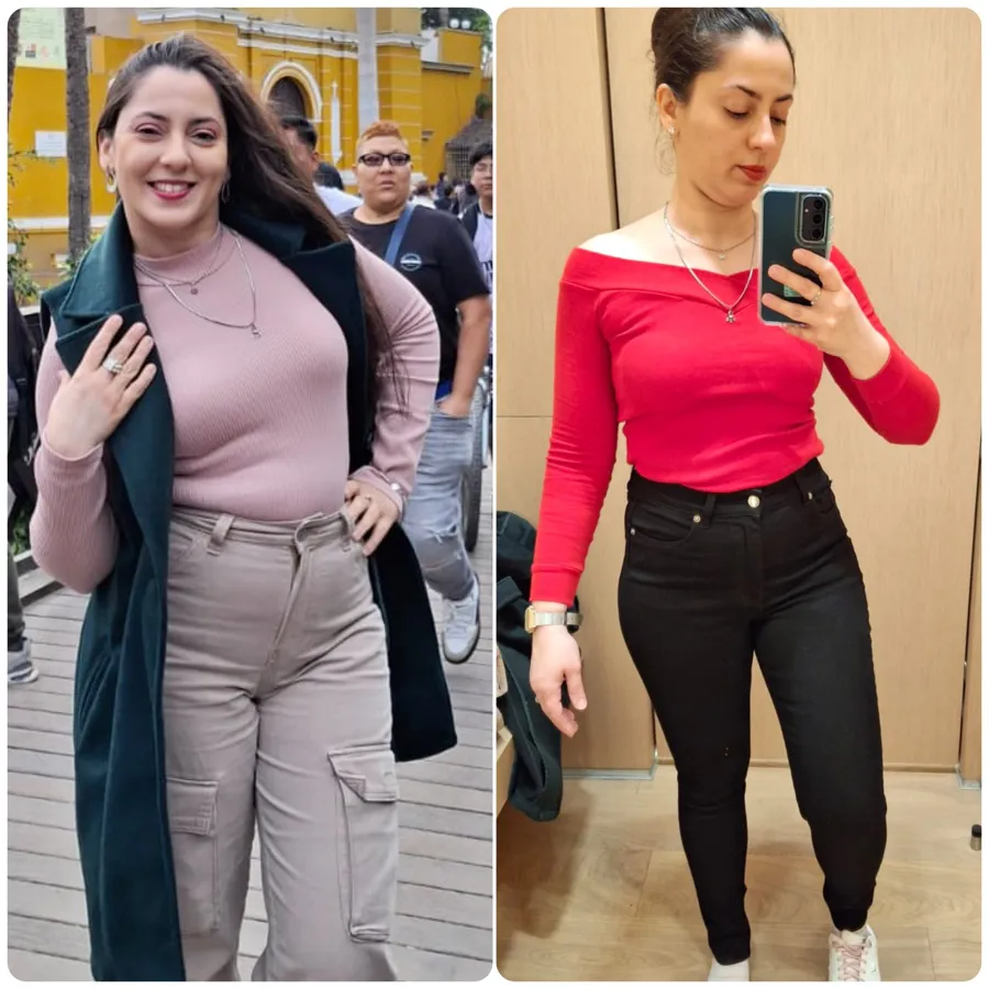 Thiago Gomes · antes y después reales de clientas